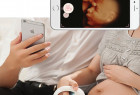 Marvoto一款可让孕妇随时为肚里宝宝拍照的产品