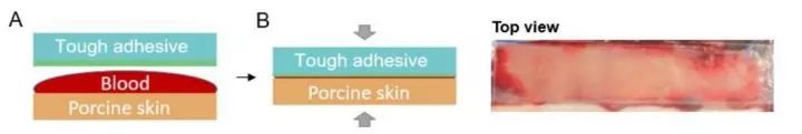 哈佛大学研制出了新型医用贴膜，修补内脏效果良好